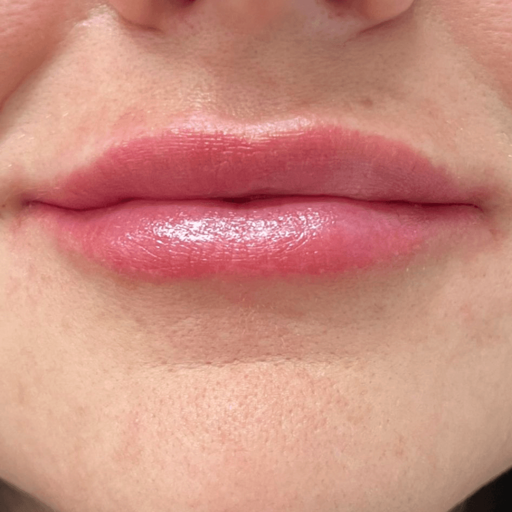 Lippen nach der Behandlung